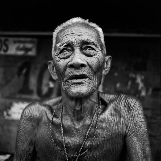Blind_man_awaiting_cataract_surgery