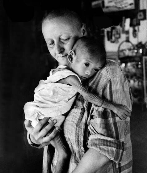 Child_with_aids