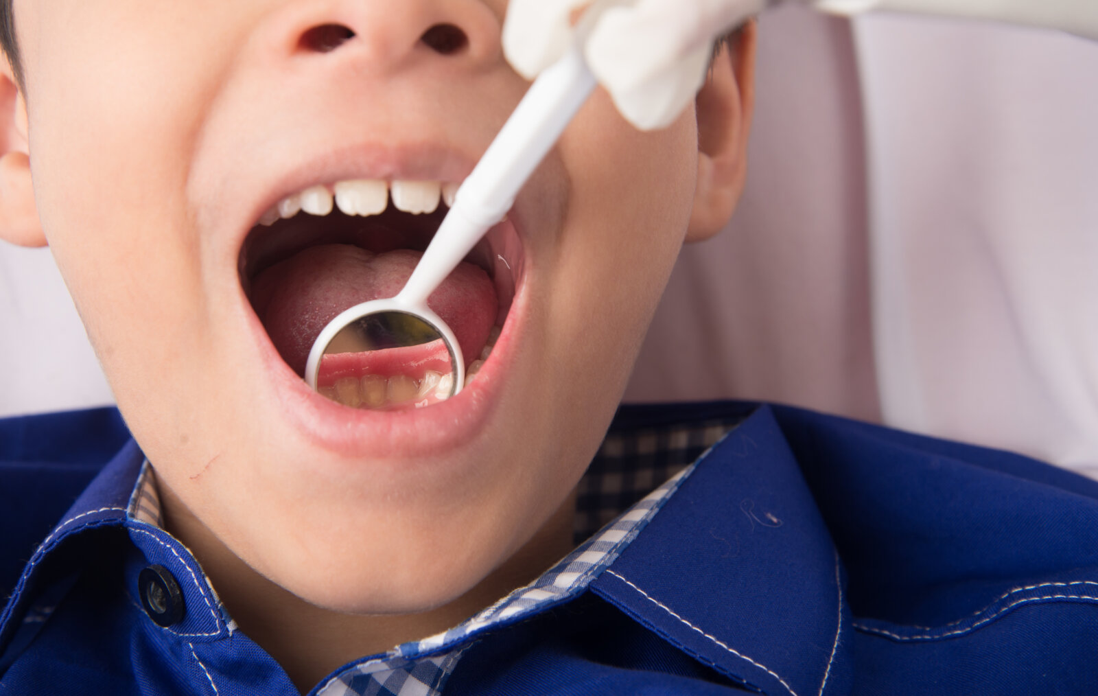 childs first dental cleaning