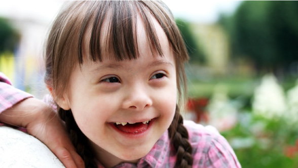 Thick cortex could be key in Down syndrome 