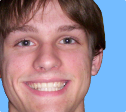 Ryan Kopf Smile