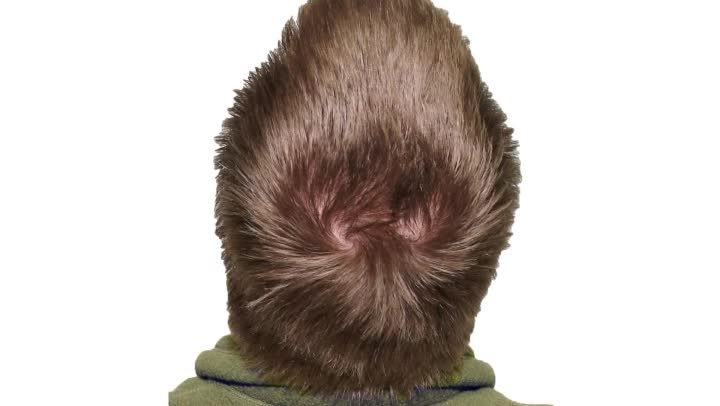 Video How To Deal With Curly Hair With Cowlicks EHow Video How To Deal With Curly Hair With Cowlicks EHow