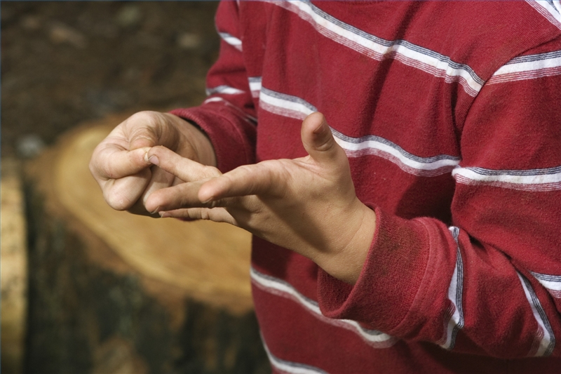 How to Treat a Splinter Infection Healthfully