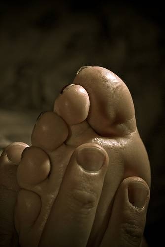 Diabetic Nerve Pain Symptoms | Healthy Living