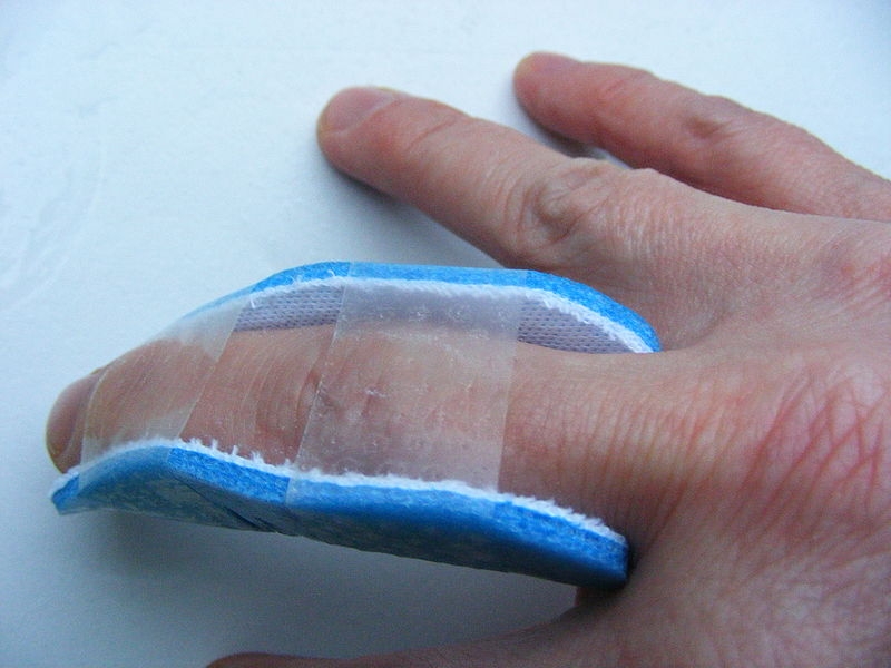 Trigger Finger Cures Healthfully