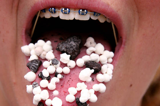 Braces___dippin_dots
