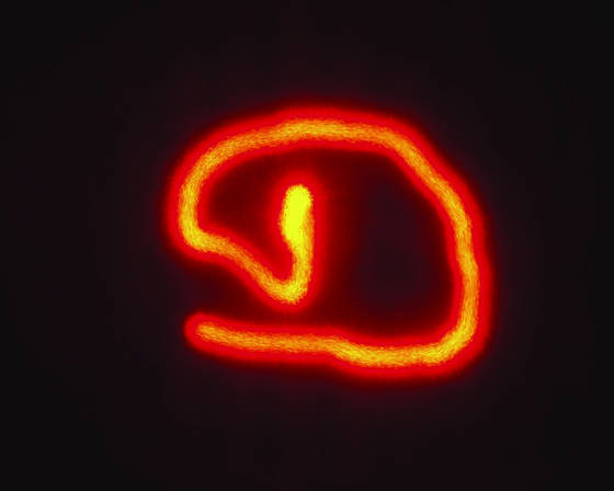 Laser