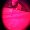 79158474