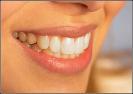Green Lake Dentistry: New Patient Package
