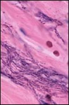 disease_rec1.jpg