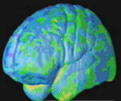 developingbrainsmall.jpg