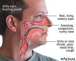 HayFever.jpg