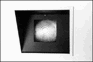 Patient Exam Light Asymmetrical Patient Exam Light Asymmetrical