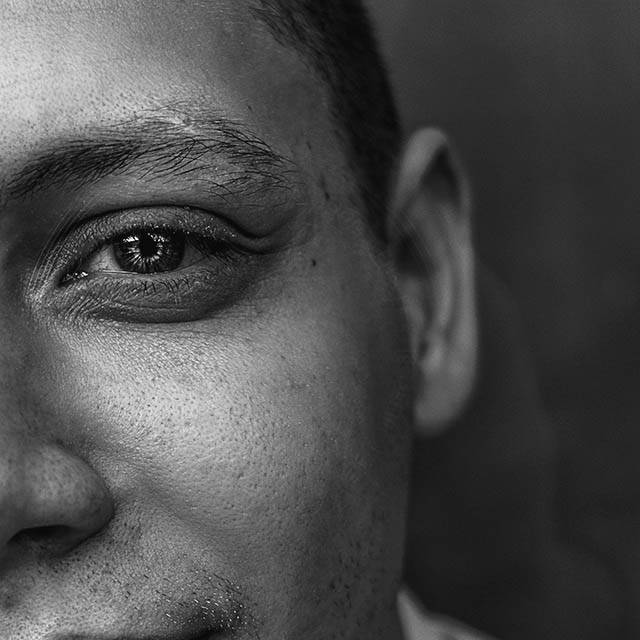 What is Dry Eye Syndrome?