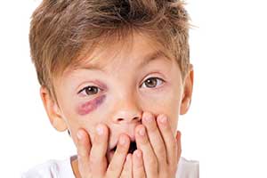 eye injury boy