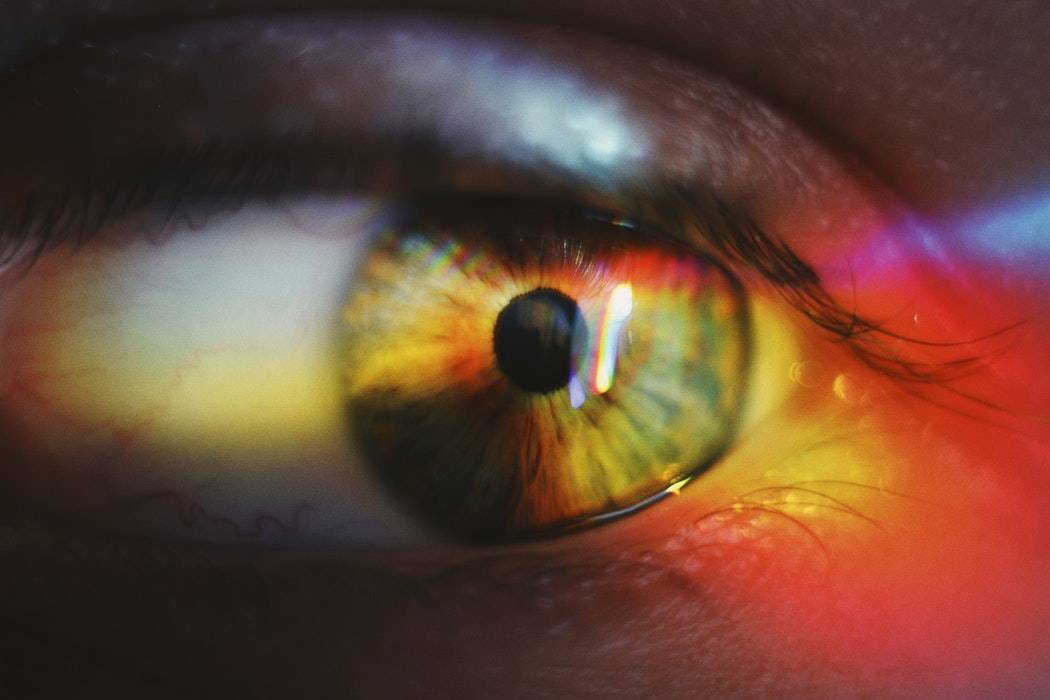 Close Up of Eye with Poor Vision from Albinism