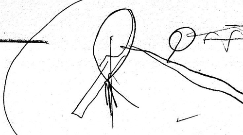 Erko-skits-009_large