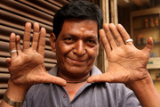 Man_with_thirteen_fingers