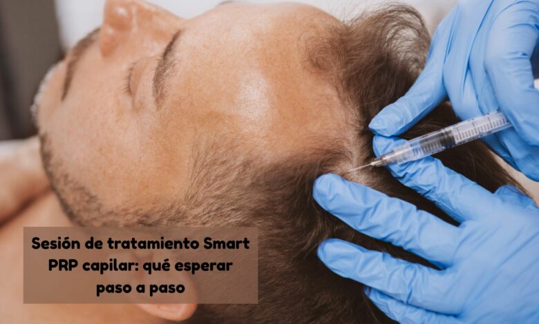 Sesión de tratamiento Smart PRP capilar: qué esperar paso a paso Sesión de tratamiento Smart PRP capilar: qué esperar paso a paso