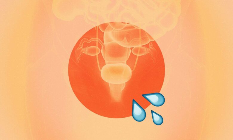 Urinary Incontinence: Causes, Leakage, Types & Treatment Urinary Incontinence: Causes, Leakage, Types & Treatment