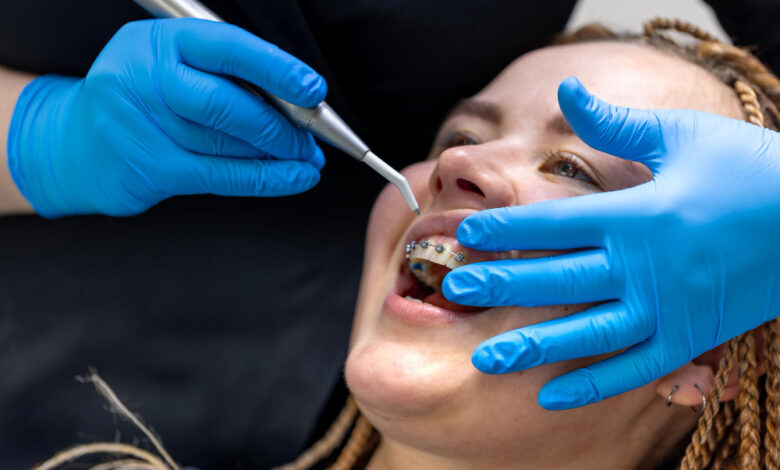 Where to Find the Most Accurate Denturists Email List? Where to Find the Most Accurate Denturists Email List?