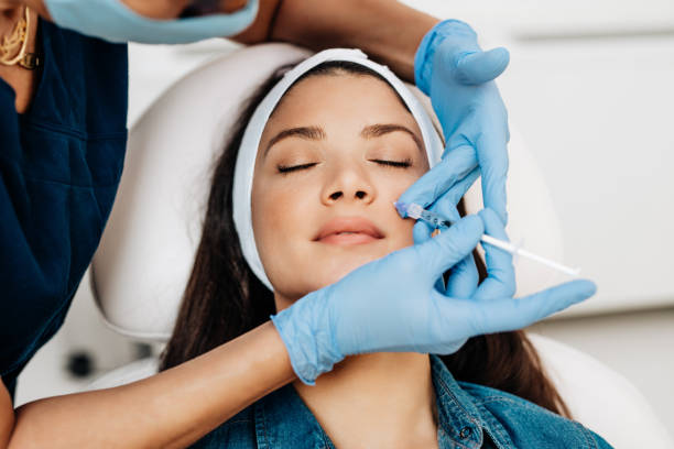 Can Volift Fillers Smooth Deep Smile Lines? Can Volift Fillers Smooth Deep Smile Lines?