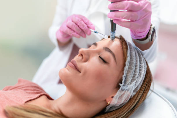 How Long Do RF Micro Needling Results Last? How Long Do RF Micro Needling Results Last?