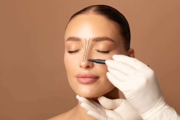 Who Is the Ideal Candidate for Rhinoplasty ? Who Is the Ideal Candidate for Rhinoplasty ?
