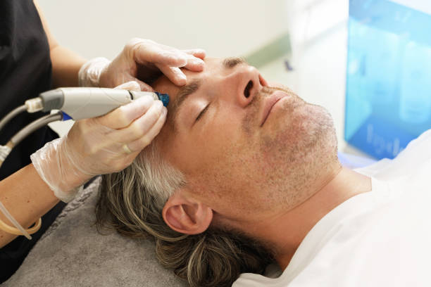 Why Choose Laser Skin Resurfacing for Skin Renewal? Why Choose Laser Skin Resurfacing for Skin Renewal?