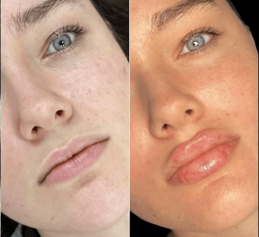 Best Plastic Surgeons in dubai for Fillers for Non-Surgical Makeovers Best Plastic Surgeons in dubai for Fillers for Non-Surgical Makeovers