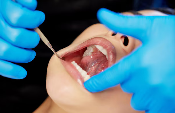 Full Mouth Restoration – Comprehensive Dental Rehabilitation Full Mouth Restoration – Comprehensive Dental Rehabilitation