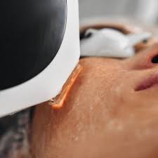 Advanced Cold Laser Therapy for Natural Pain Relief Advanced Cold Laser Therapy for Natural Pain Relief