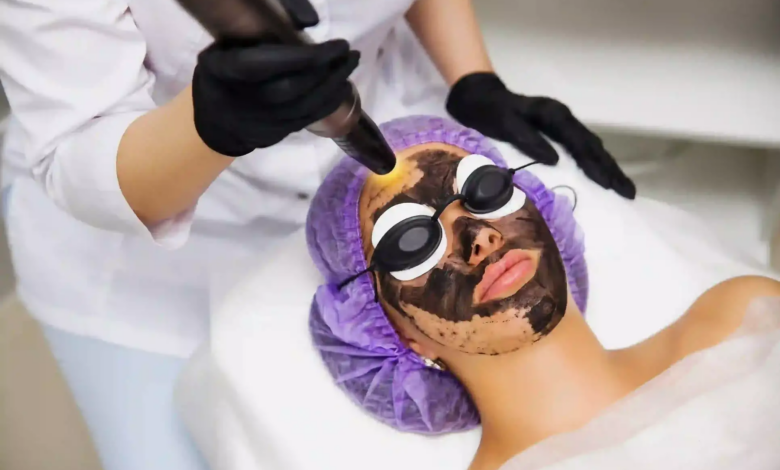 How Quickly Can Laser Carbon Peel Restore Your Natural Skin Glow? How Quickly Can Laser Carbon Peel Restore Your Natural Skin Glow?