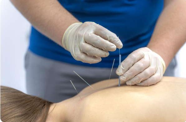 5 Ways Acupuncture Helps Balance Hormones and Boost Reproductive Health 5 Ways Acupuncture Helps Balance Hormones and Boost Reproductive Health