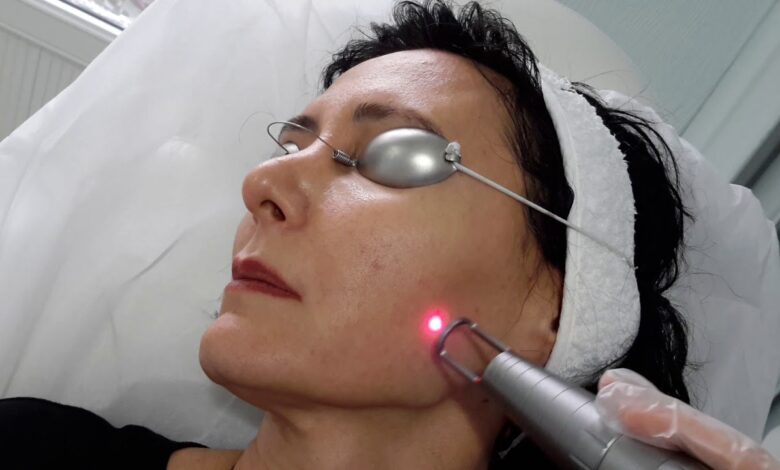 Is Pico Laser Treatment Safe for Treating Hyperpigmentation? Is Pico Laser Treatment Safe for Treating Hyperpigmentation?