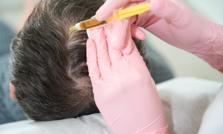 What Makes PRP a Good Solution for Hair Thinning? What Makes PRP a Good Solution for Hair Thinning?