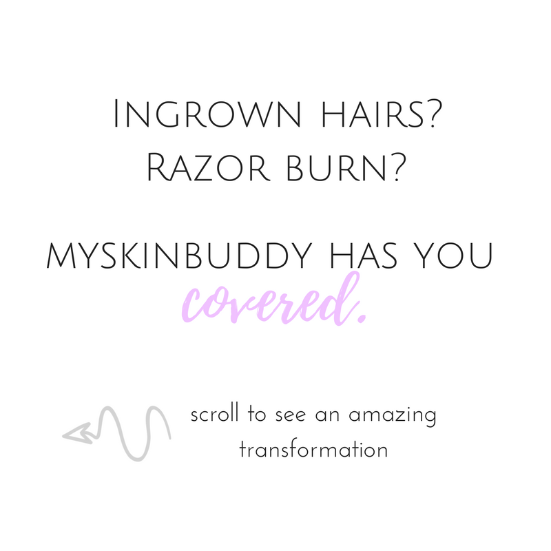 100 Myskinbuddy Ideas Blue Light Therapy Led Light Therapy Facial Devices