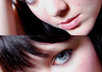 Before-and-after
