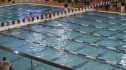 w hs 100 scy breast final hA d2