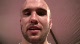 Adam Dehart post fight