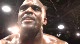 Artenas Young post fight
