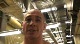 Chad Hoar post fight