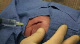 Head Stitch