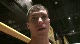 James Vick broke his hand during the fight