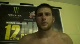 Ryan Brunke post fight