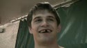 Brendon Ard Minus 1 Tooth