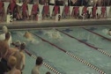 SWC 100 Breast
