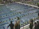 Women 100 Breast- Consols