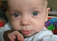 Mikko Rials: Funds for Gastroschisis Baby