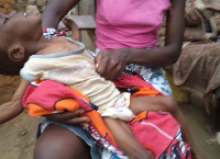 AIDS/HIV Assistance Program for the Needy